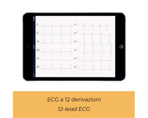 Кишеньковий ЕКГ-монітор D-Heart ПРОФЕСІЙНИЙ ЕКГ-АПАРАТ сумісний з IOS та Android