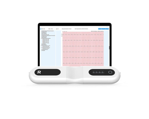 Цілодобовий монітор ЕКГ Wellue ER1-LW Dynamic ECG Recoder для дому