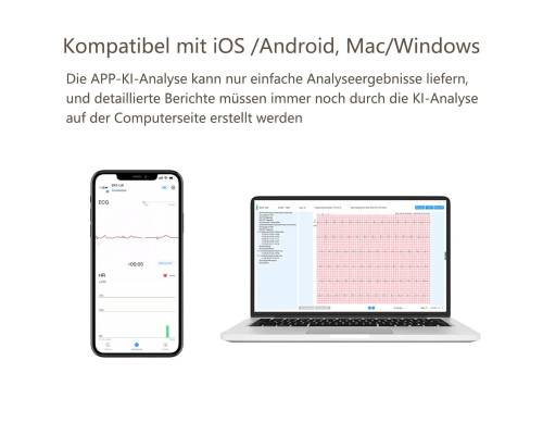 Цілодобовий монітор ЕКГ Wellue ER1-LW Dynamic ECG Recoder для дому