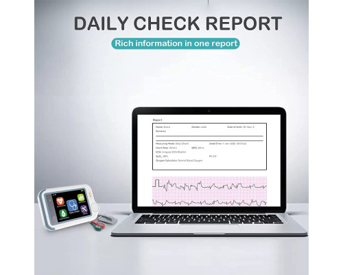 ЕКГ-монітор із пульсоксиметром ViATOM Checkme Lite Plus