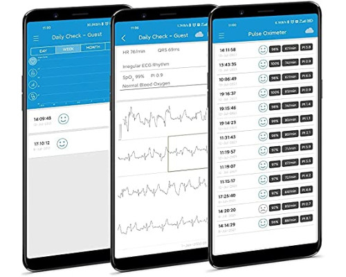 ЕКГ-монітор із пульсоксиметром ViATOM Checkme Lite Plus
