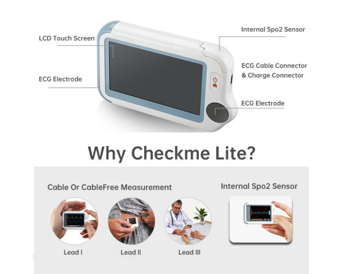 ЕКГ-монітор із пульсоксиметром ViATOM Checkme Lite Plus